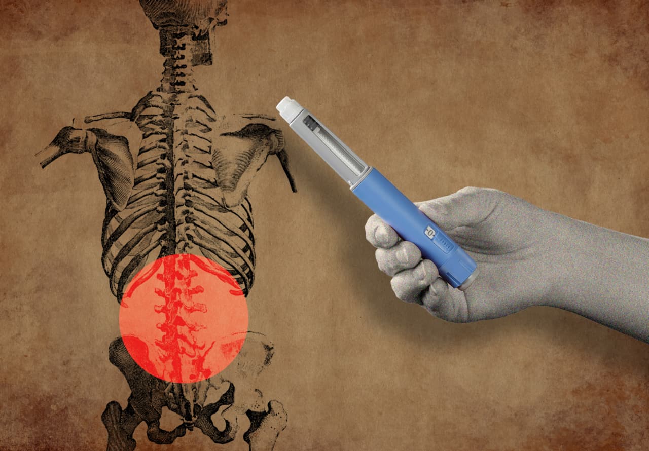 GLP-1s could offer unexpected relief from back and knee pain, but doctors urge caution